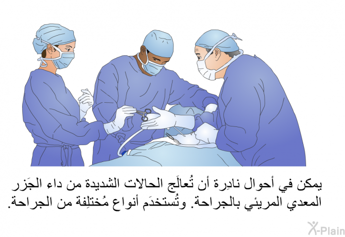 يمكن في أحوال نادِرة أن تُعالَج الحالات الشديدة من داء الجَزر المعدي المريئي بالجراحة. وتُستخدَم أنواع مُختلِفة من الجراحة.