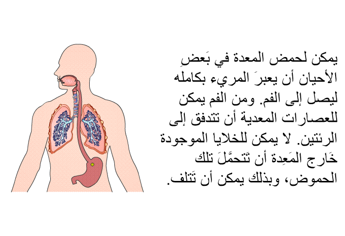 يمكن لحمض المعدة في بَعضِ الأحيان أن يعبرَ المريء بكامله ليصل إلى الفم. ومن الفم يمكن للعصارات المعدية أن تتدفق إلى الرئتين. لا يمكن للخلايا الموجودة خَارج المَعِدة أن تَتحمَّلَ تلك الحموض، وبذلك يمكن أن تَتلف.