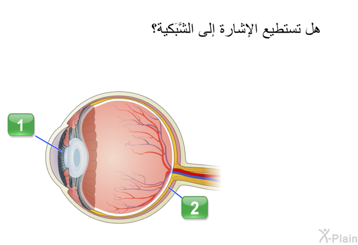 هل تستطيع الإشارة إلى الشَّبَكية؟