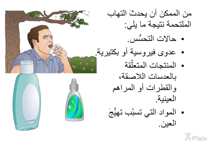 من الممكن أن يحدثَ التهاب الملتحمة نتيجة ما يلي:  حالات التحسُّس. عدوى فيروسية أو بكتيرية. المنتجات المتعلِّقة بالعدسات اللاصقة، والقطرات أو المراهم العينية. المواد التي تسبِّب تهيُّجَ العين.