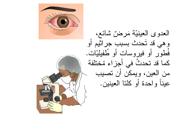 العدوى العينيّة مَرضٌ شائع، وهي قد تَحدث بسبب جراثيم أو فُطور أو فيروسات أو طُفيليّات. كما قد تحدثُ في أجزاء مُختلفة من العين، ويمكن أن تصيب عيناً واحدة أو كلتا العينين.