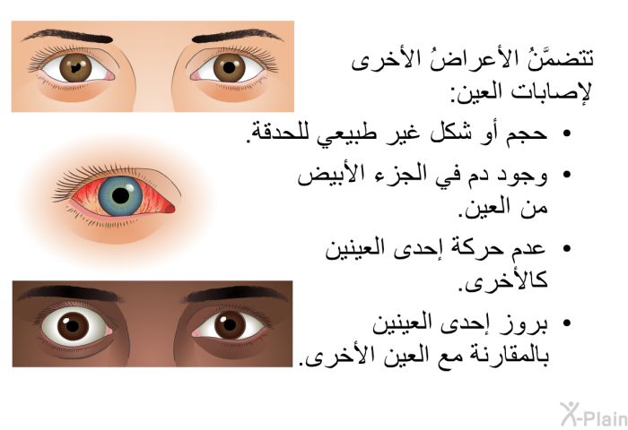 تتضمَّنُ الأعراضُ الأخرى لإصابات العين:   حجم أو شكل غير طبيعي للحدقة.  وجود دم في الجزء الأبيض من العين.  عدم حركة إحدى العينين كالأخرى. بروز إحدى العينين بالمقارنة مع العين الأخرى.