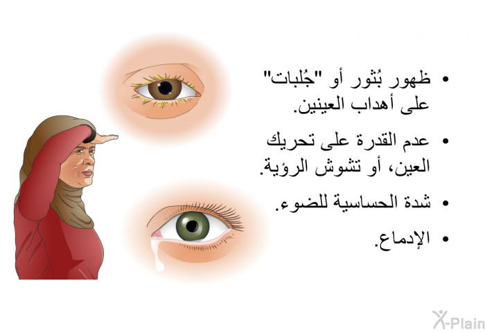ظهور بُثور أو "جُلبات" على أهداب العينين.  عدم القدرة على تحريك العين، أو تشوش الرؤية.  شدة الحساسية للضوء. الإدماع.
