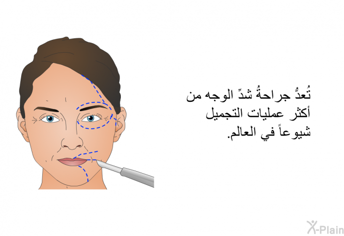 تُعدُّ جراحةُ شدِّ الوجه من أكثر عمليات التجميل شيوعاً في العالم.