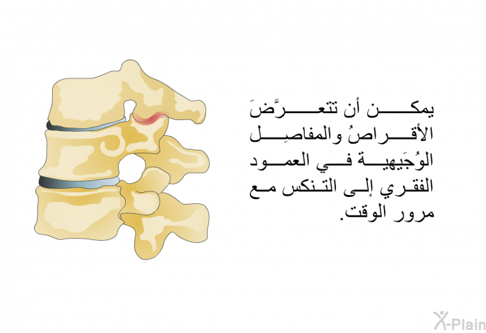 يمكن أن تتعرَّضَ الأقراصُ والمفاصِل الوُجَيهية في العمود الفقري إلى التنكس مع مرور الوقت.