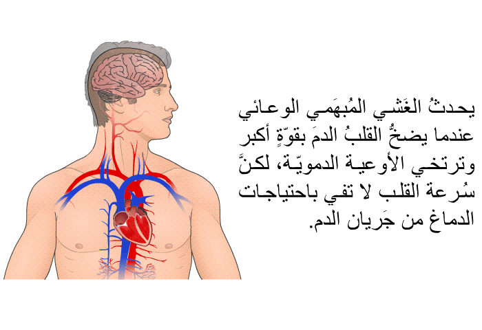 يحدثُ الغَشي المُبهَمي الوعائي عندما يضخُّ القلبُ الدمَ بقوّةٍ أكبر وترتخي الأوعية الدمويّة، لكنَّ سُرعة القلب لا تفي باحتياجات الدماغ من جَريان الدم.