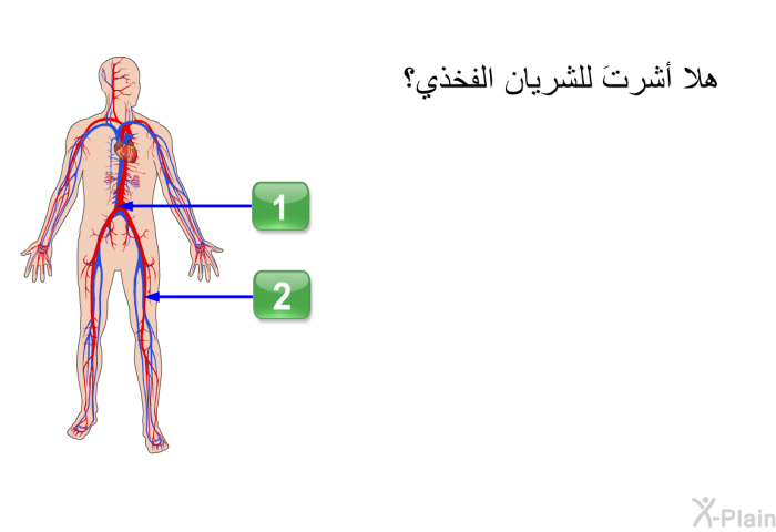 هلا أشرتَ للشريان الفخذي؟