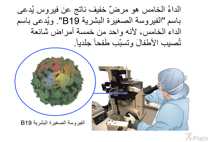 الداءُ الخامس هو مرضٌ خفيف ناتج عن فيروس يُدعى باسم "الفيروسة الصغيرة البشرية B19". ويُدعى باسم الداء الخامس، لأنه واحد من خمسة أمراض شائعة تُصيب الأطفالَ وتسبِّب طَفحاً جلدياً.