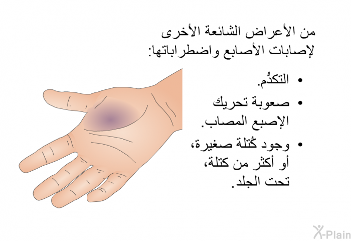 من الأعراض الشائعة الأخرى لإصابات الأصابع واضطراباتها:   التكدُّم.  صعوبة تحريك الإصبع المصاب. وجود كُتلة صغيرة، أو أكثر من كتلة، تحت الجلد.