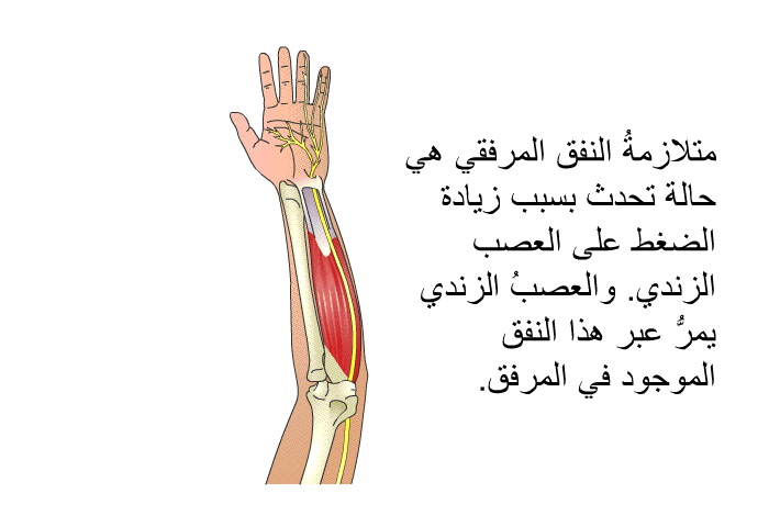 متلازمةُ النفق المرفقي هي حالة تحدث بسبب زيادة الضغط على العصب الزندي. والعصبُ الزندي يمرُّ عبر هذا النفق الموجود في المرفق.