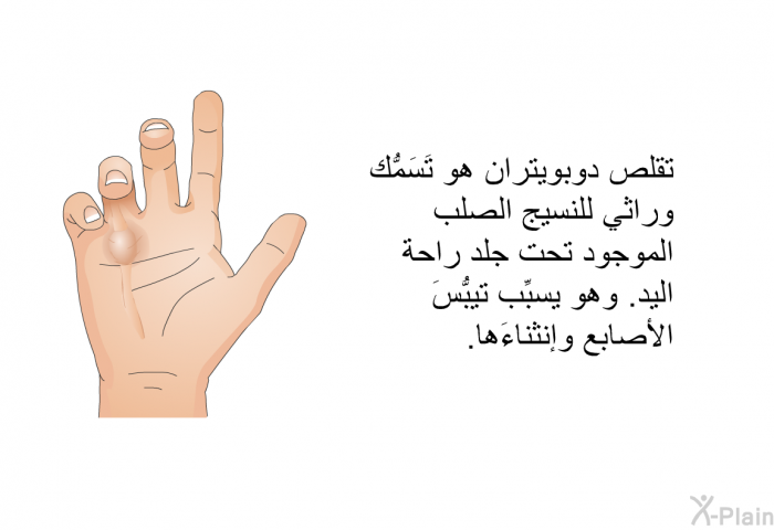 تقلص دوبويتران هو تَسَمُّك وراثي للنسيج الصلب الموجود تحت جلد راحة اليد. وهو يسبِّب تيبُّسَ الأصابع وانثناءَها.