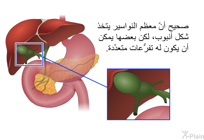 صحيح أنَّ معظم النواسير يتخذ شكل أنبوب، لكن بعضها يمكن أن يكون له تفرُّعات متعدِّدة.