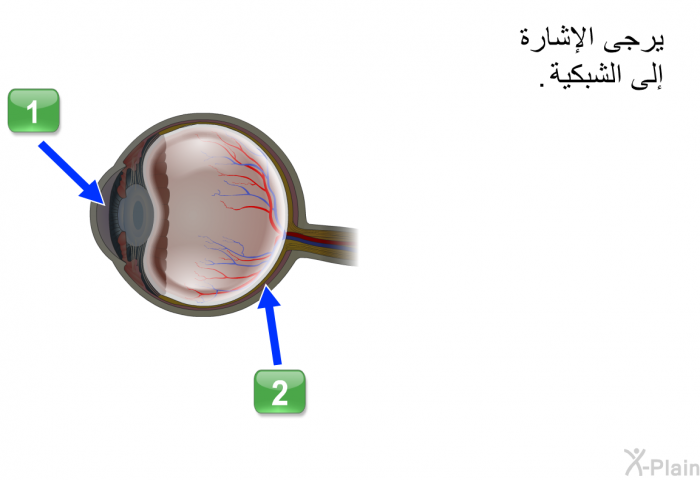 يرجى الإشارة إلى الشبكية.