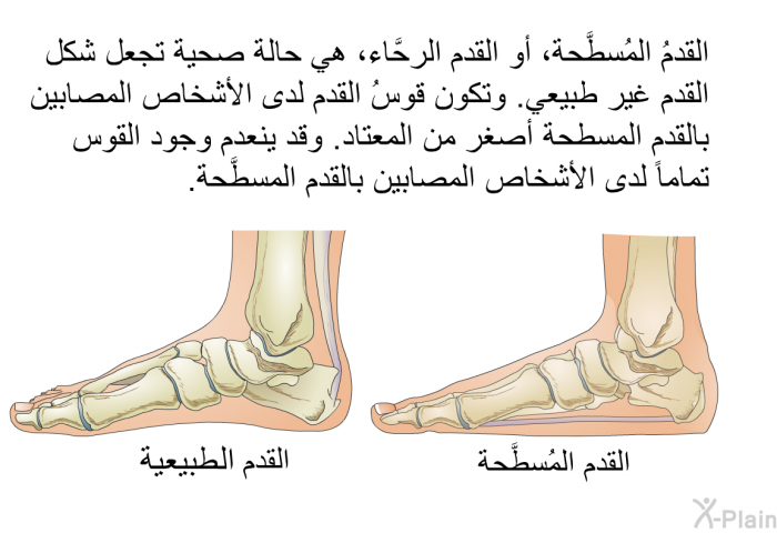 القدمُ المُسطَّحة، أو القدم الرحَّاء، هي حالة صحية تجعل شكل القدم غير طبيعي. وتكون قوسُ القدم لدى الأشخاص المصابين بالقدم المسطحة أصغر من المعتاد. وقد ينعدم وجود القوس تماماً لدى الأشخاص المصابين بالقدم المسطَّحة.