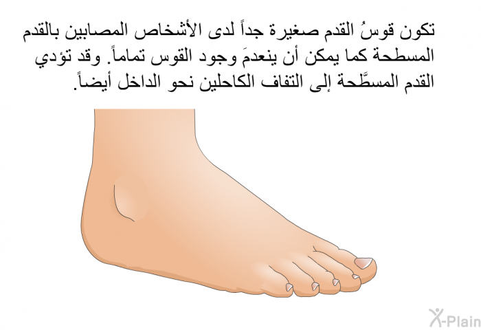 تكون قوسُ القدم صغيرة جداً لدى الأشخاص المصابين بالقدم المسطحة كما يمكن أن ينعدمَ وجود القوس تماماً. وقد تؤدي القدم المسطَّحة إلى التفاف الكاحلين نحو الداخل أيضاً.