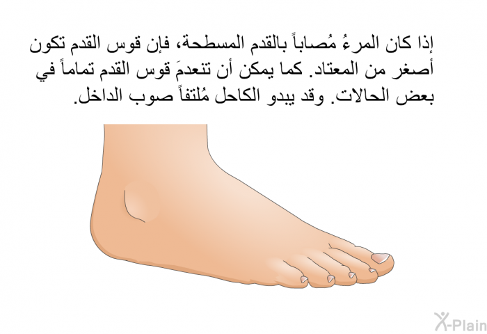 إذا كان المرءُ مُصاباً بالقدم المسطحة، فإن قوس القدم تكون أصغر من المعتاد. كما يمكن أن تنعدمَ قوس القدم تماماً في بعض الحالات. وقد يبدو الكاحل مُلتفاً صوب الداخل.