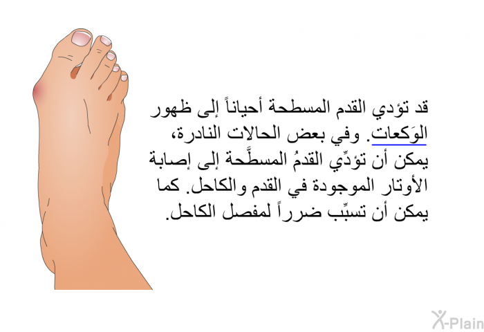 قد تؤدي القدم المسطحة أحياناً إلى ظهور الوَكعات. وفي بعض الحالات النادرة، يمكن أن تؤدِّي القدمُ المسطَّحة إلى إصابة الأوتار الموجودة في القدم والكاحل. كما يمكن أن تسبِّب ضرراً لمفصل الكاحل.