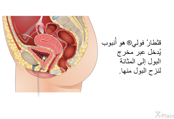 قثطارُ فولي  هو أُنبوب يُدخل عبر مُخرج البول إلى المثانة لنزح البول منها.