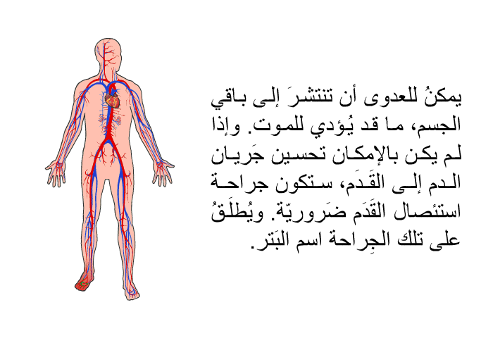 يمكنُ للعدوى أن تنتشرَ إلى باقي الجسم، ما قد يُؤدي للموت. وإذا لم يكن بالإمكان تحسين جَريان الدم إلى القَدَم، ستكون جراحة استئصال القَدَم ضَروريّة. ويُطلَقُ على تلك الجِراحة اسم البَتر.