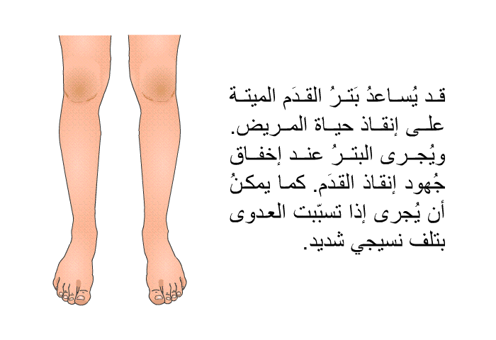 قد يُساعدُ بَترُ القدَم الميتة على إنقاذ حياة المريض. ويُجرى البترُ عند إخفاق جُهود إنقاذ القدَم. كما يمكنُ أن يُجرى إذا تسبّبت العدوى بتلف نسيجي شديد.