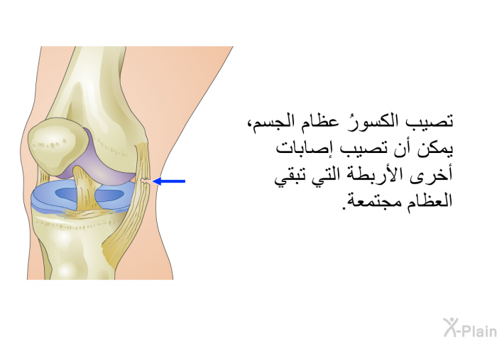 تصيب الكسورُ عظام الجسم، يمكن أن تصيب إصابات أخرى الأربطة التي تبقي العظام مجتمعة.