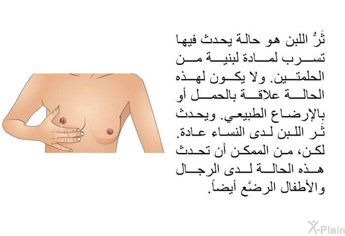 ثَرُّ اللبن هو حالةٌ يحدث فيها تسرب لمادة لبنية من الحلمتين. ولا يكون لهذه الحالة علاقة بالحمل أو بالإرضاع الطبيعي. ويحدث ثَر اللبن لدى النساء عادة. لكن، من الممكن أن تحدث هذه الحالة لدى الرجال والأطفال الرضَّع أيضاً.