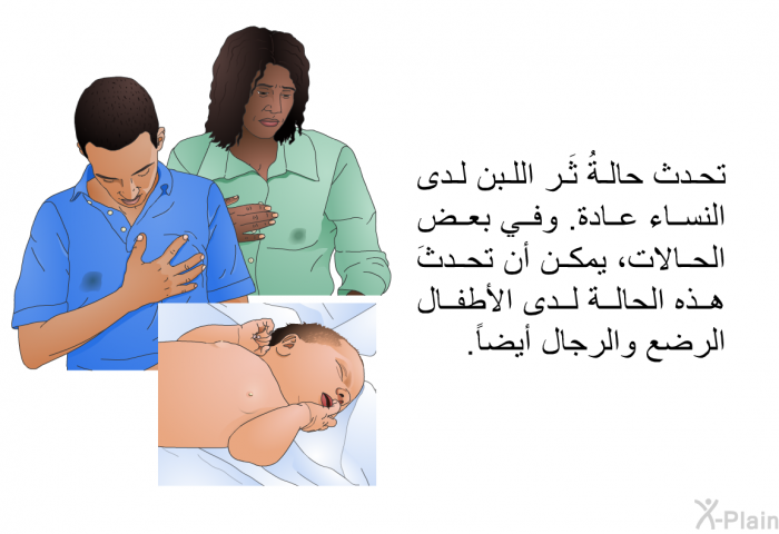 تحدث حالةُ ثَر اللبن لدى النساء عادة. وفي بعض الحالات، يمكن أن تحدثَ هذه الحالة لدى الأطفال الرضع والرجال أيضاً.
