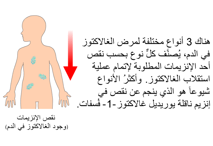 هناك 3 أنواع مختلفة لمرض الغالاكتوز في الدم، يُصنَّف كلٌّ نوع بحسب نقص أحد الإنزيمات المطلوبة لإتمام عملية استقلاب الغالاكتوز. وأكثرُ الأنواع شيوعاً هو الذي ينجم عن نقص في إنزيم ناقلة يوريديل غالاكتوز -1- فُسفات.