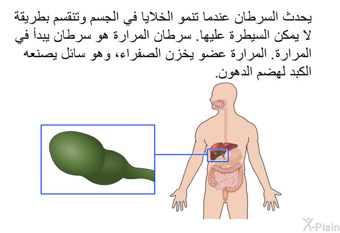 يحدث السرطان عندما تنمو الخلايا في الجسم وتنقسم بطريقة لا يمكن السيطرة عليها. سرطان المرارة هو سرطان يبدأ في المرارة. المرارة عضو يخزن الصفراء، وهو سائل يصنعه الكبد لهضم الدهون.