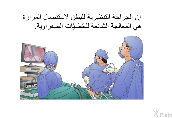 إن الجراحة التنظيرية للبطن لاستئصال المرارة هي المعالجة الشائعة للحُصَيَّات الصفراوية.
