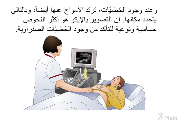 وعند وجود الحُصَيَّات، ترتد الأمواج عنها أيضاً، وبالتالي يتحدد مكانها. إن التصوير بالإيكو هو أكثر الفحوص حساسية ونوعية للتأكد من وجود الحُصَيَّات الصفراوية.