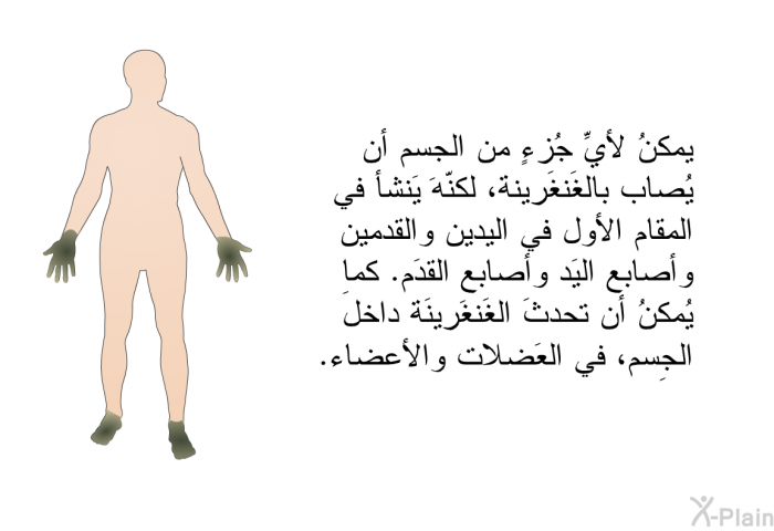 يمكنُ لأيِّ جُزءٍ من الجِسم أن يُصاب بالغَنغَرينة، لكنّه يَنشأ في المقام الأول في اليدين والقدمين وأصابع اليَد وأصابع القدَم. كما يُمكنُ أن تحدثَ الغَنغَرينَة داخلَ الجِسم، في العَضلات والأعضاء.