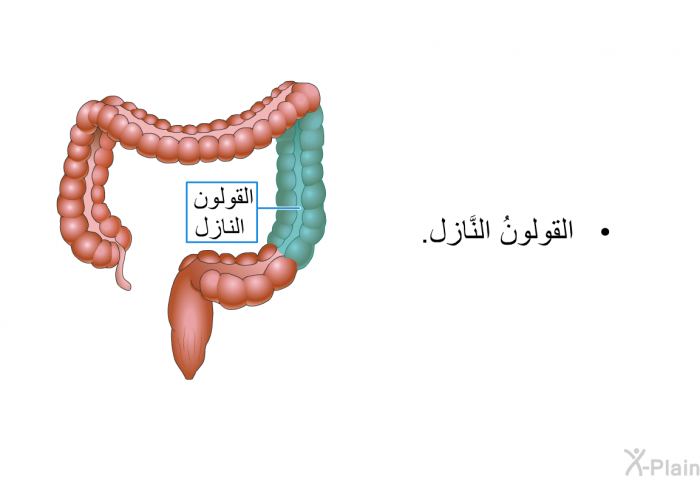 القولونُ النَّازل.