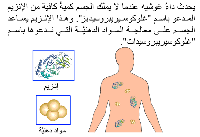 يحدث داءُ غوشيه عندما لا يملك الجسم كميةً كافية من الإنزيم المدعو باسم "غلوكوسيريبروسيديز". وهذا الإنزيم يساعد الجسم على معالجة المواد الدهنيَّة التي ندعوها باسم "غلوكوسيريبروسيدات".