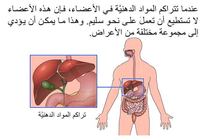عندما تتراكم المواد الدهنيَّة في الأعضاء، فإن هذه الأعضاء لا تستطيع أن تعملَ على نحو سليم. وهذا ما يمكن أن يؤدي إلى مجموعة مختلفَة من الأعراض.