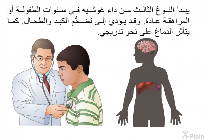 يبدأ النوعُ الثالث من داء غوشيه في سنوات الطفولة أو المراهقة عادة. وقد يؤدي إلى تضخُّم الكبد والطحال. كما يتأثر الدماغ على نحو تدريجي.