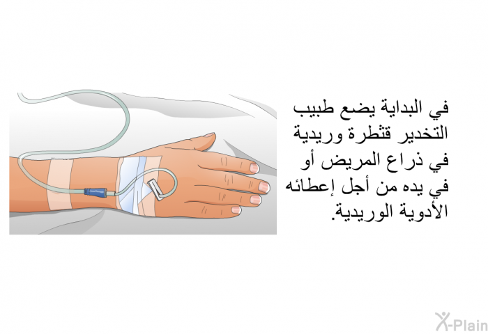 في البداية يضع طبيب التخدير قثطرة وريدية في ذراع المريض أو في يده من أجل إعطائه الأدوية الوريدية.