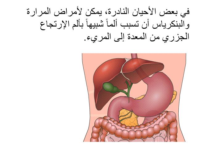 في بعض الأحيان النادرة، يمكن لأمراض المرارة والبنكرياس أن تسبب ألماً شبيهاً بألم الإرتجاع الجزري من المعدة إلى المريء.