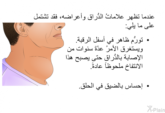 عندما تظهر علاماتُ الدُّراق وأعراضه، فقد تشتمل على ما يلي:  تورُّم ظاهر في أسفل الرقبة. ويستغرق الأمرُ عدَّةَ سنوات من الإصابة بالدُّراق حتى يصبح هذا الانتفاخ ملحوظاً عادة. إحساس بالضيق في الحلق.