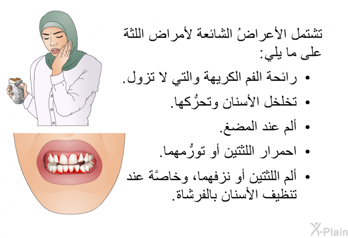 تشتمل الأعراضُ الشائعة لأمراض اللثة على ما يلي:  رائحة الفم الكريهةوالتي لا تزول. تخلخل الأسنان وتحرُّكها. ألم عند المضغ. احمرار اللثتين أو تورُّمهما. ألم اللثتين أو نزفهما، وخاصَّة عند تنظيف الأسنان بالفرشاة.