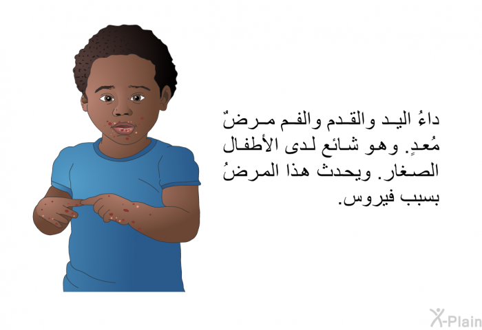 داءُ اليد والقدم والفم مرضٌ مُعدٍ. وهو شائع لدى الأطفال الصغار. ويحدث هذا المرضُ بسبب فيروس.