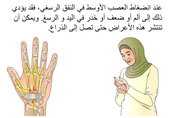 عندَ انضغاط العصب الأوسط في النفق الرسغي، فقد يؤدي ذلك إلى ألم أو ضعف أو خَدَر في اليد و الرسغ. ويمكن أن تنتشر هذه الأعراض حتى تصل إلى الذراع.