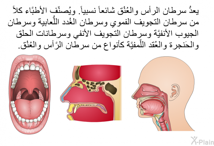 يعدُّ سرطان الرأس والعُنُق شائعاً نسبياً. ويُصنِّف الأطبَّاء كلاً من سرطان التجويف الفموي وسرطان الغُدد اللُّعابية وسرطان الجيوب الأنفيَّة وسرطان التجويف الأنفي وسرطانات الحلق والحَنجرة والعُقد اللِّمفيَّة كأنواع من سرطان الرَّأس والعُنُق.