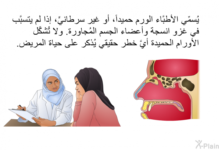 يُسمِّي الأطبَّاء الورم حميداً، أو غير سرطانيٍّ، إذا لم يتسبَّب في غزو انسجة وأعضاء الجسم المُجاورة. ولا تُشكِّل الأورام الحميدة أيَّ خطر حقيقي يُذكر على حياة المريض.