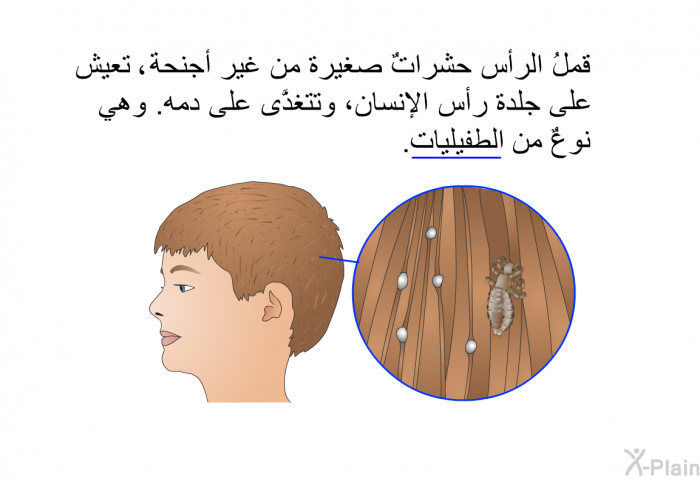 قملُ الرأس حشراتٌ صغيرة من غير أجنحة، تعيش على جلدة رأس الإنسان، وتتغذَّى على دمه. وهي نوعٌ من الطُّفيليات.