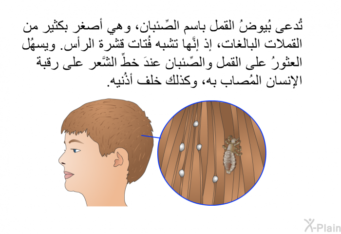 تُدعى بُيوضُ القمل باسم الصِّئبان، وهي أصغر بكثير من القملات البالغات، إذ إنَّها تشبه فُتات قشرة الرأس. ويسهُل العثورُ على القمل والصِّئبان عندَ خطِّ الشَّعر على رقبة الإنسان المُصاب به، وكذلك خلف أذُنيه.