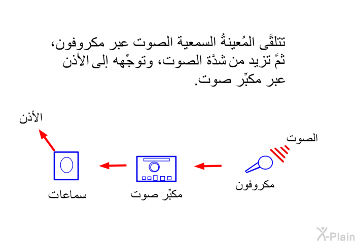 تتلقَّى المُعينةُ السمعية الصوت عبر مكروفون، ثمَّ تزيد من شدَّة الصوت، وتوجِّهه إلى الأذن عبر مكبِّر صوت.