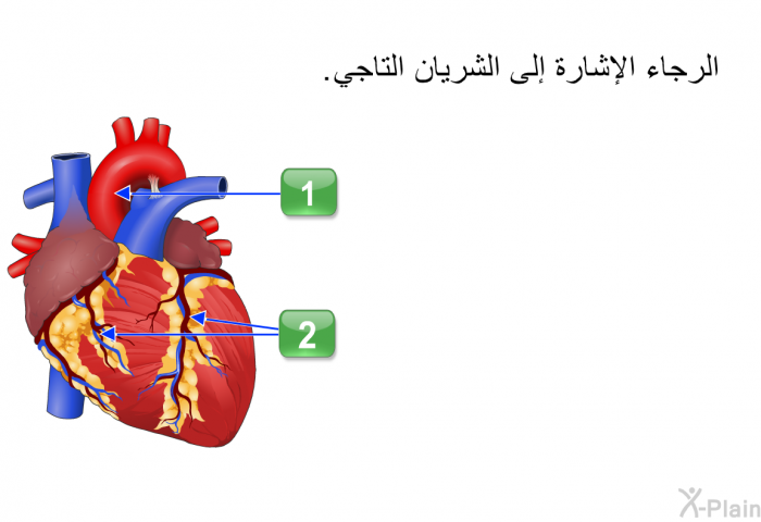 هل تستطيع الإشارة إلى الشرايين التاجية؟