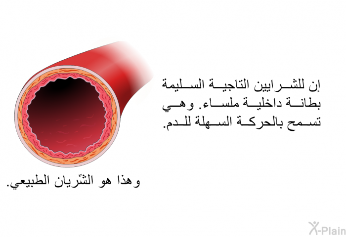 إن للشرايين التاجية السليمة بطانة داخلية ملساء. وهي تسمح بالحركة السهلة للدم. وهذا هو الشِّريان الطبيعي.