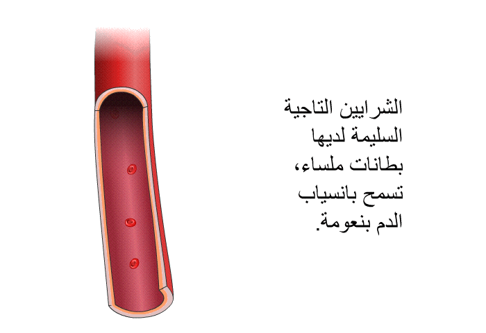 الشرايين التاجية السليمة لديها بطانات ملساء، تسمح بانسياب الدم بنعومة.